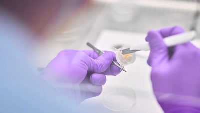 Ebola